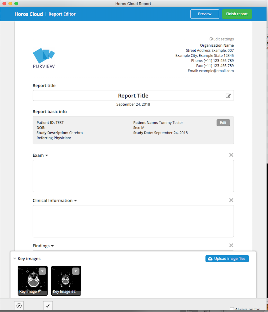 osirix mac torrent