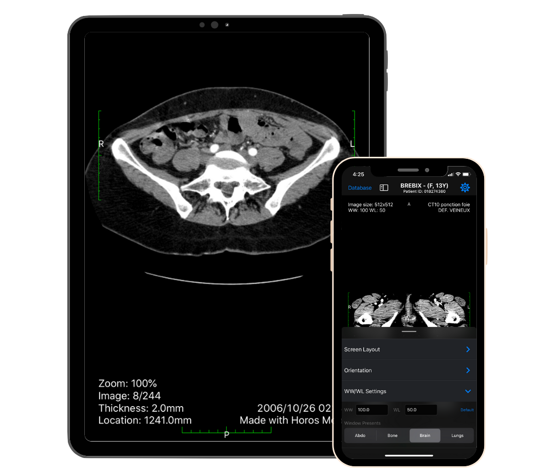 horos dicom viewer mac download